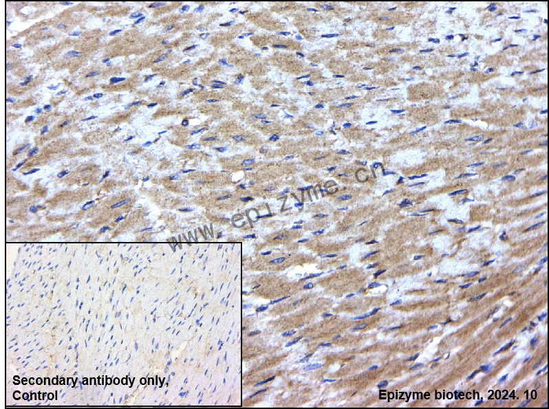 Anti-PP2A alpha/beta Rabbit mAb [45L80L68]
