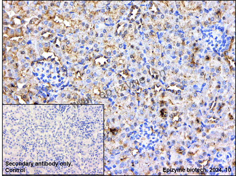 Anti-PP2A alpha/beta Rabbit mAb [45L80L68]