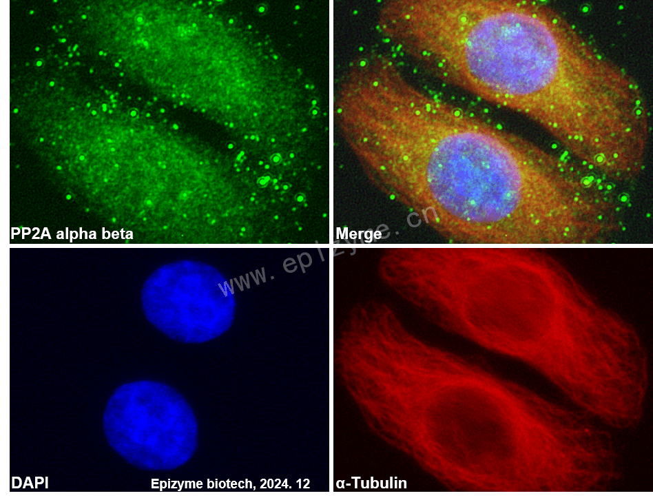 Anti-PP2A alpha/beta Rabbit mAb [45L80L68]