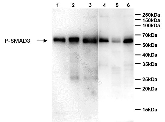 Anti-Phospho-Smad3 (Ser423/425) Rabbit mAb [11L61K22]