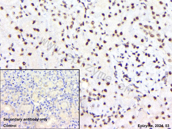 Anti-Phospho-Smad3 (Ser423/425) Rabbit mAb [11L61K22]