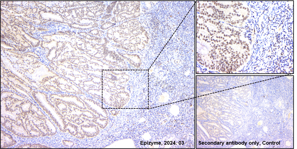 Anti-Phospho-Smad3 (Ser423/425) Rabbit mAb [11L61K22]