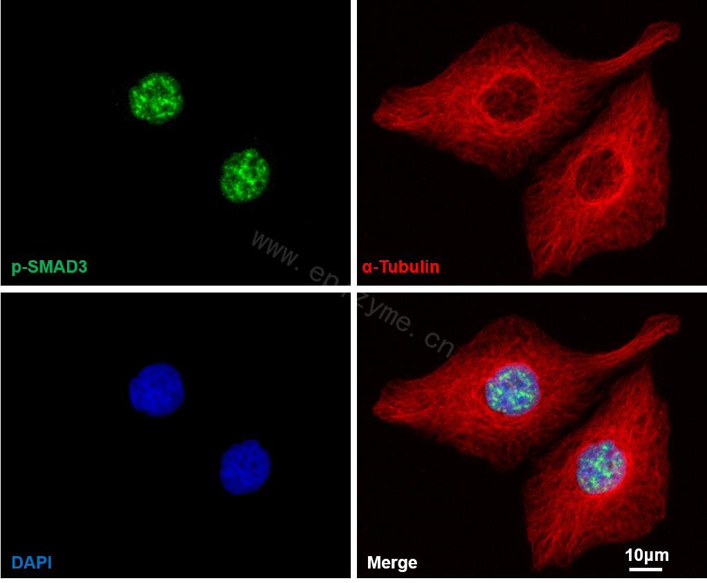 Anti-Phospho-Smad3 (Ser423/425) Rabbit mAb [11L61K22]