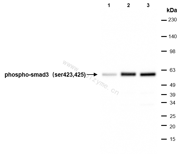 Anti-Phospho-Smad3 (Ser423/425) Rabbit mAb [11L61K22]