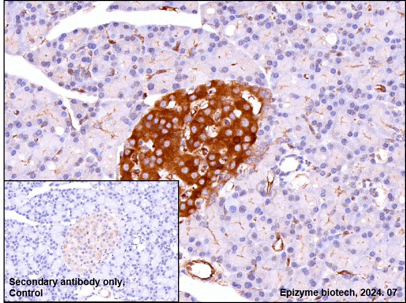 Anti-BACE1 Rabbit mAb [80L83L12]