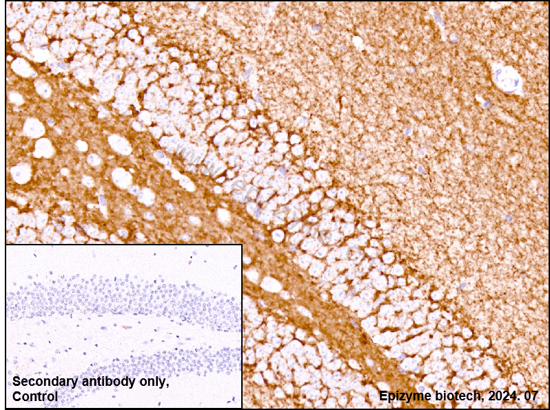 Anti-BACE1 Rabbit mAb [80L83L12]
