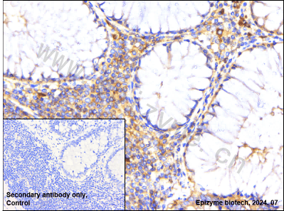 Anti-CARS Rabbit mAb [70L38L44]