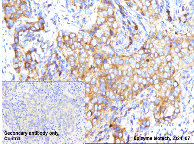 Anti-CARS Rabbit mAb [70L38L44]