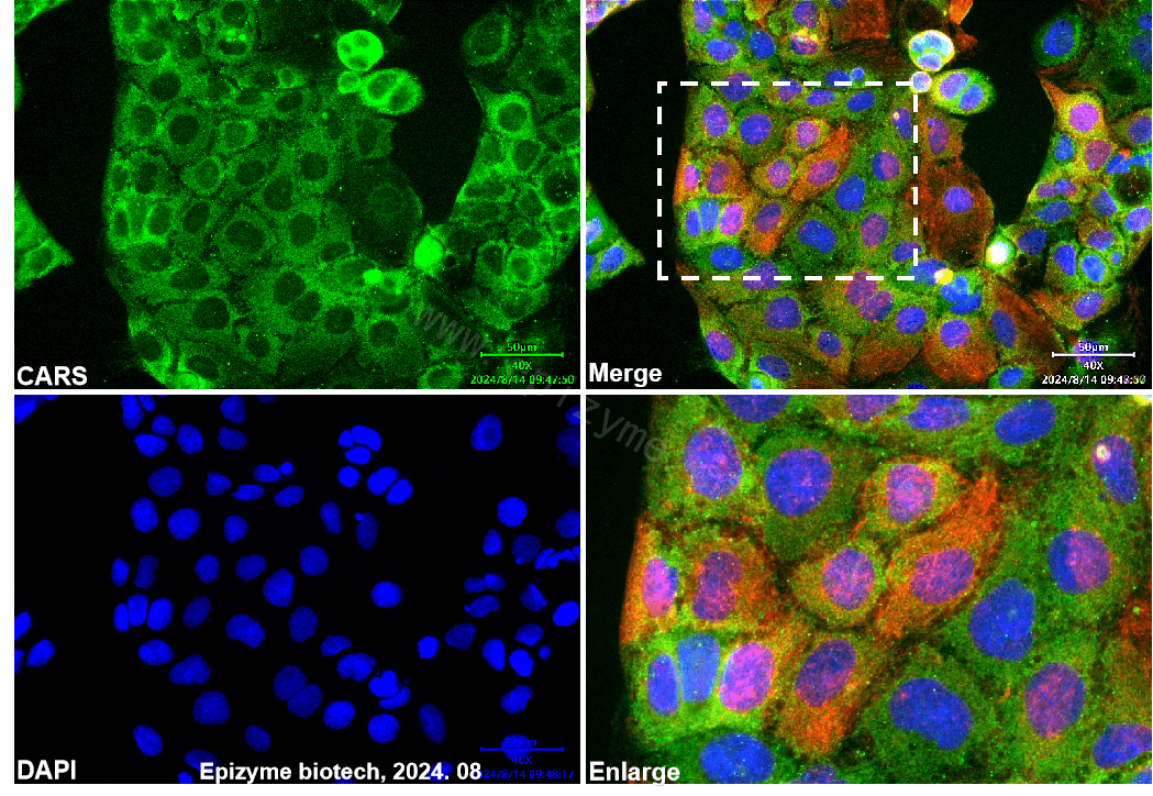 Anti-CARS Rabbit mAb [70L38L44]
