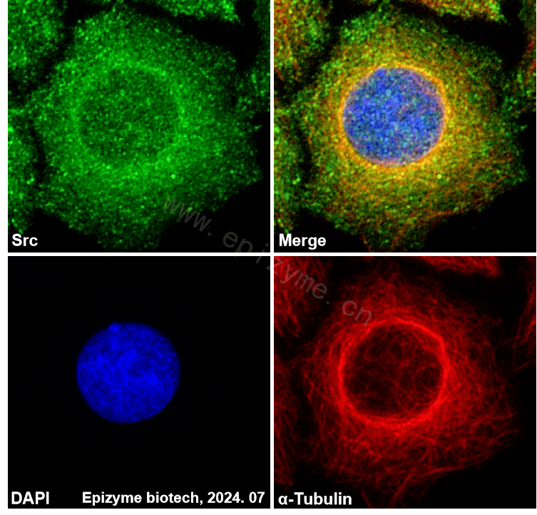 Anti-Src Rabbit mAb [66M23M78]