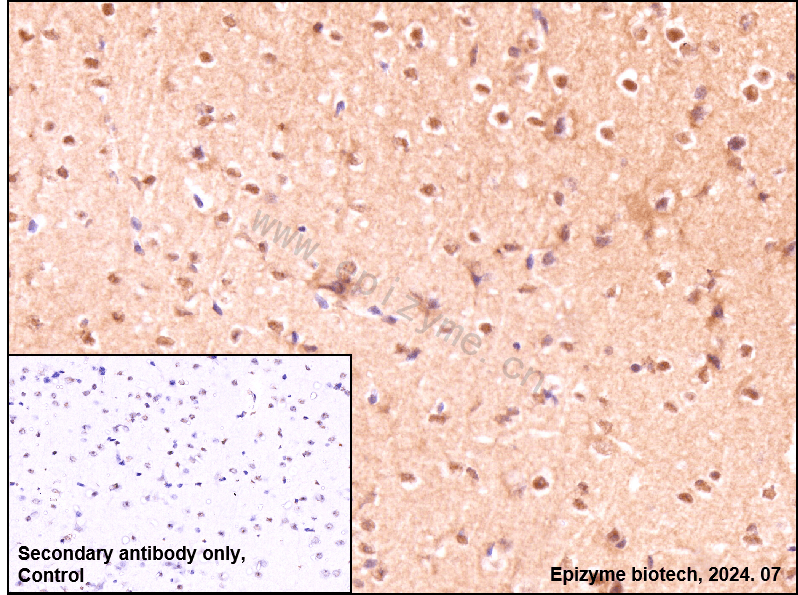 Anti-Phospho-Tau (Ser235) Rabbit mAb [26M26K75]