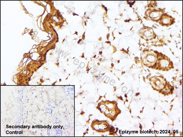 Anti-Rel B Rabbit mAb [47M74K92]