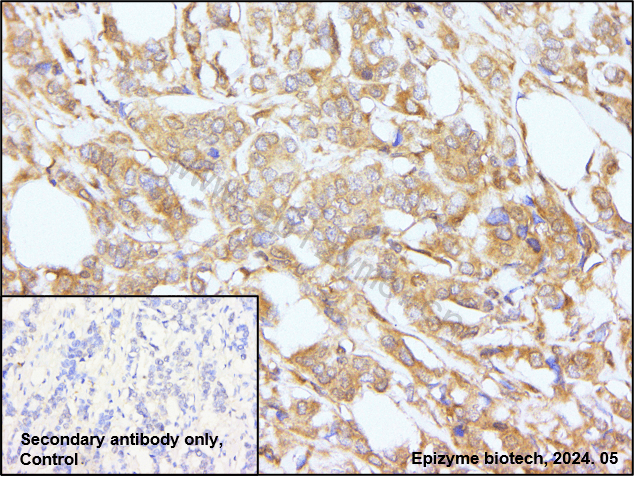 Anti-Rel B Rabbit mAb [47M74K92]