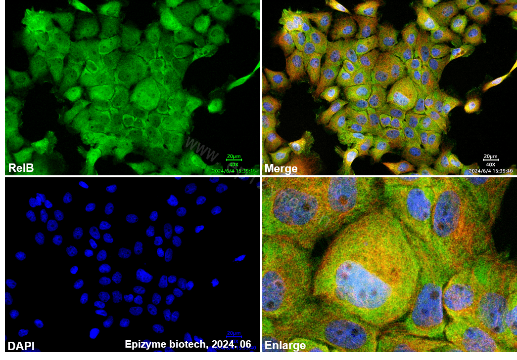 Anti-Rel B Rabbit mAb [47M74K92]