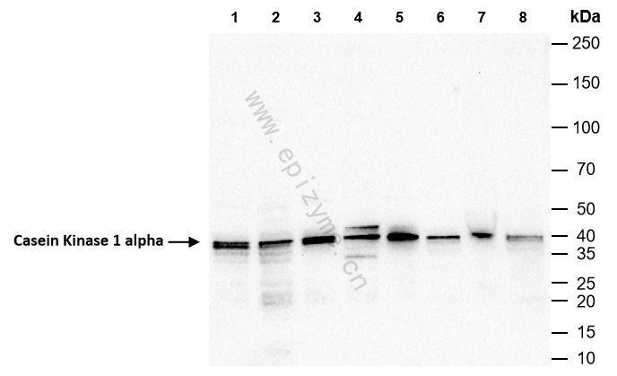 Anti-Casein Kinase 1 alpha Rabbit mAb [78M63M92]