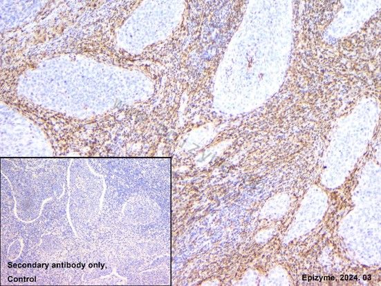 Anti-Collagen I Rabbit mAb [29E23D18]