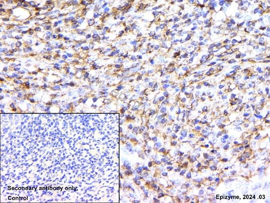 Anti-Collagen I Rabbit mAb [29E23D18]
