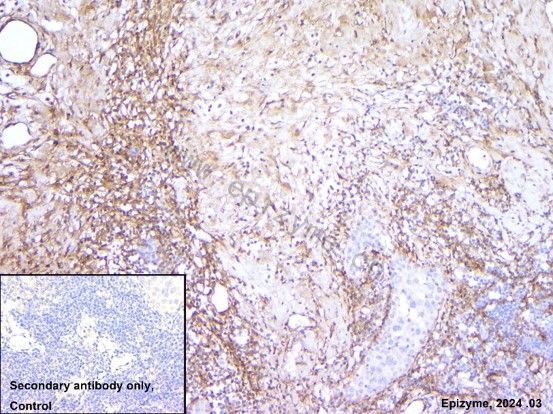 Anti-Collagen I Rabbit mAb [29E23D18]