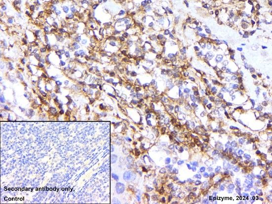 Anti-Collagen I Rabbit mAb [29E23D18]