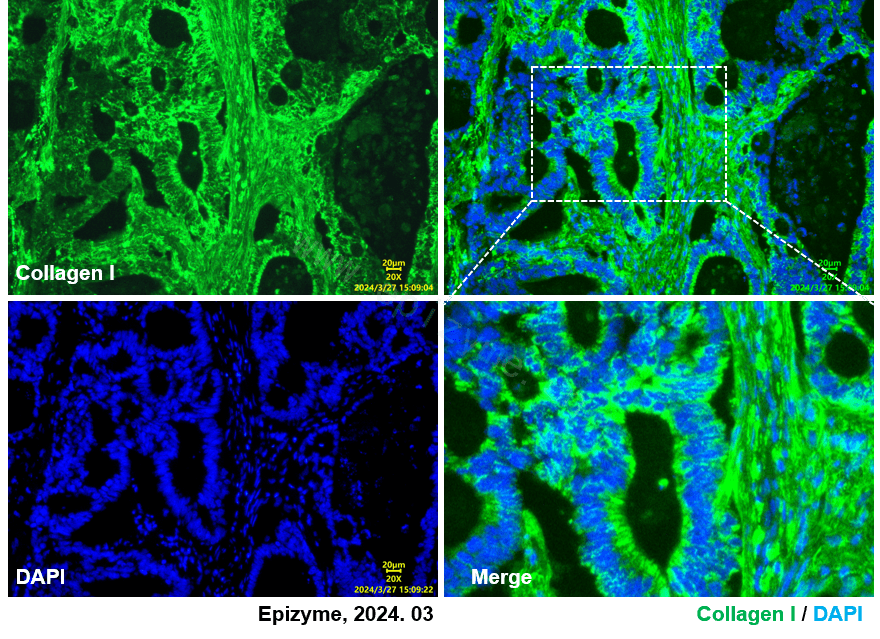 Anti-Collagen I Rabbit mAb [29E23D18]