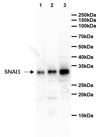 Anti-SNAI1 Rabbit mAb [29D34F31]