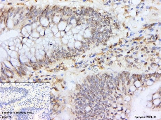 Anti-SNAI1 Rabbit mAb [29D34F31]