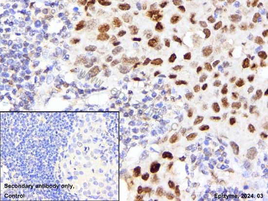 Anti-SNAI1 Rabbit mAb [29D34F31]