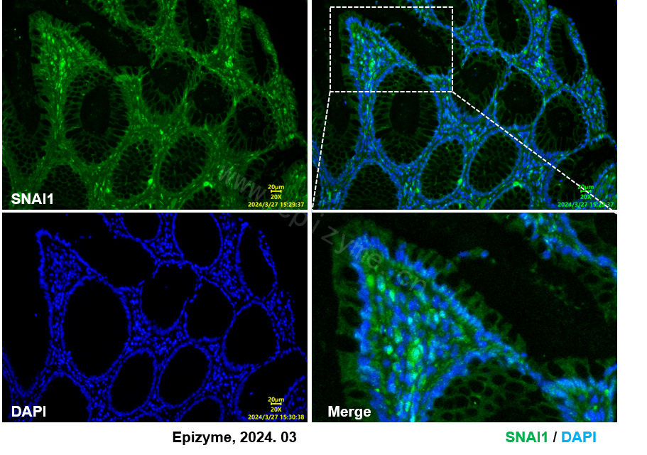 Anti-SNAI1 Rabbit mAb [29D34F31]