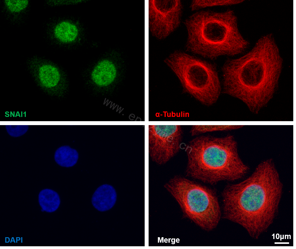 Anti-SNAI1 Rabbit mAb [29D34F31]