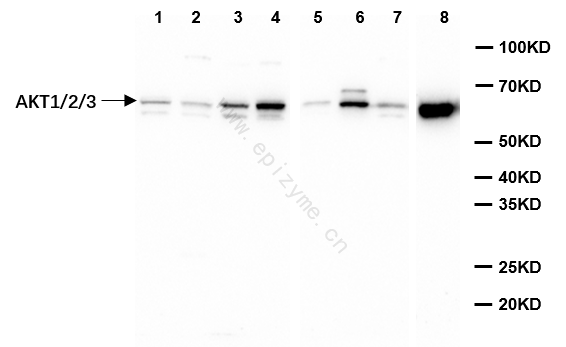Anti-AKT1/2/3 Rabbit mAb [14G32D21]