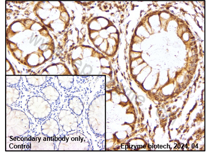 Anti-AKT1/2/3 Rabbit mAb [14G32D21]
