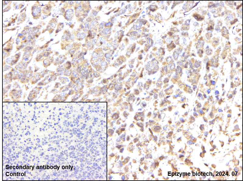 Anti-AKT1/2/3 Rabbit mAb [14G32D21]