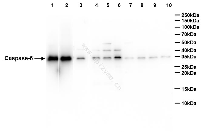 Anti-Caspase 6 Rabbit mAb [34C64B09]