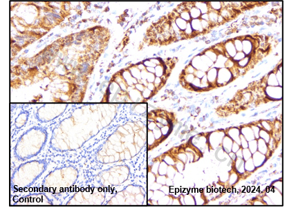 Anti-Caspase 6 Rabbit mAb [34C64B09]