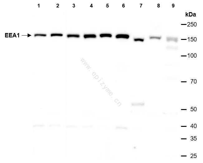 Anti-EEA1 Rabbit mAb [31E45C42]