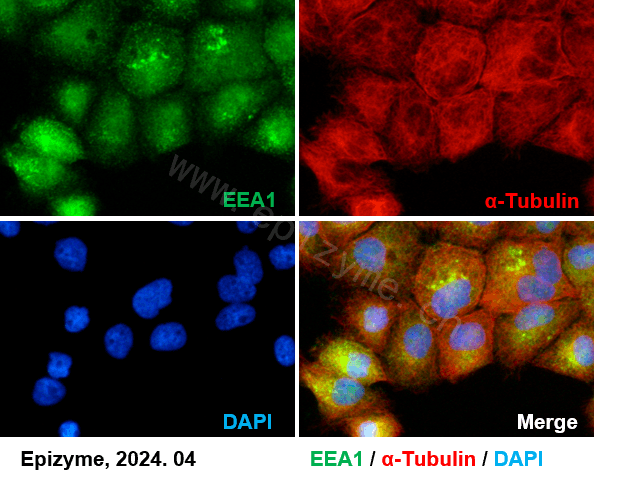 Anti-EEA1 Rabbit mAb [31E45C42]