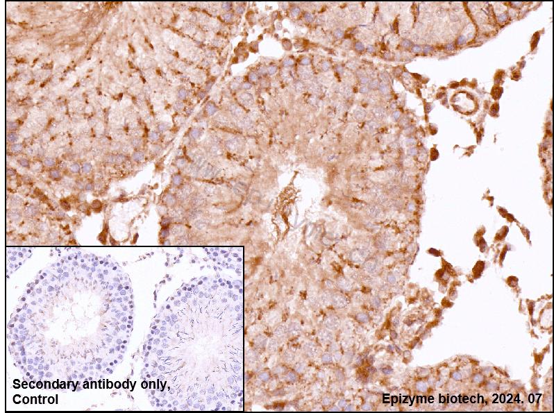 Anti-EEA1 Rabbit mAb [31E45C42]