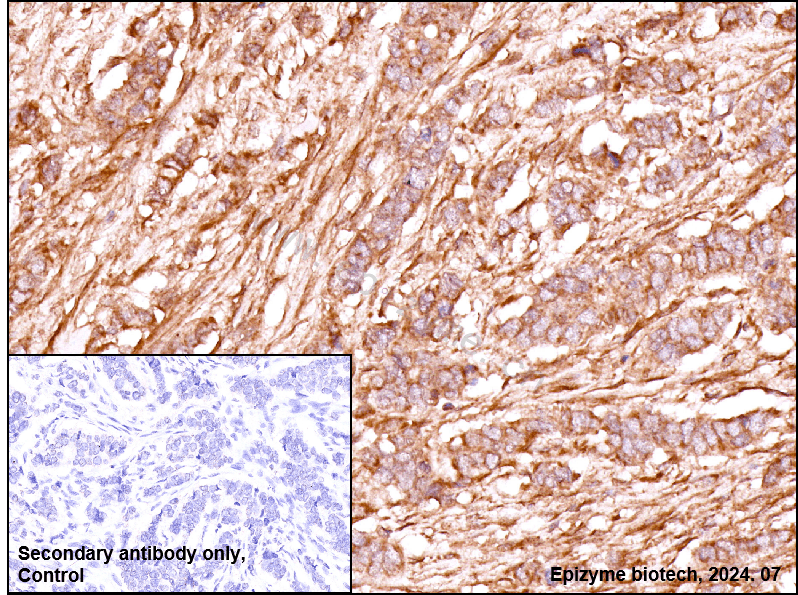 Anti-EEA1 Rabbit mAb [31E45C42]