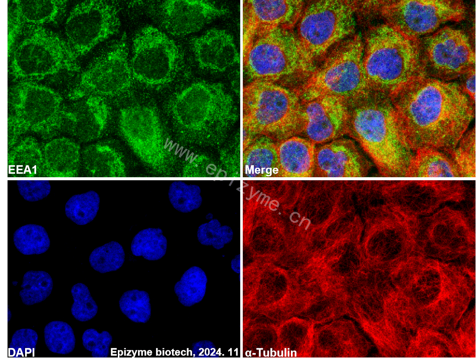 Anti-EEA1 Rabbit mAb [31E45C42]