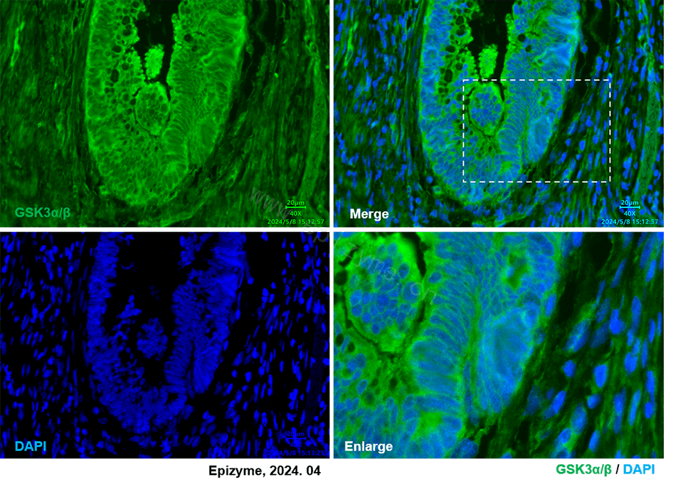 Anti-GSK3 alpha/beta Rabbit mAb [13K09G20]
