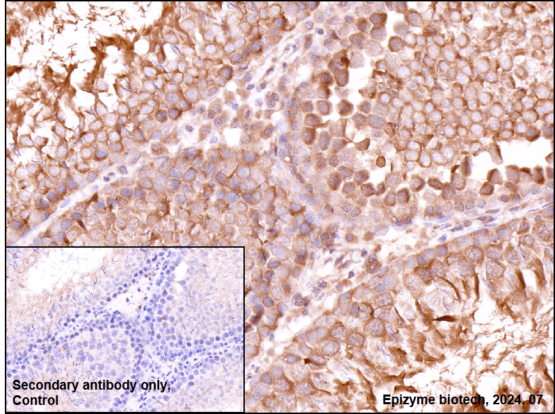 Anti-GSK3 alpha/beta Rabbit mAb [13K09G20]