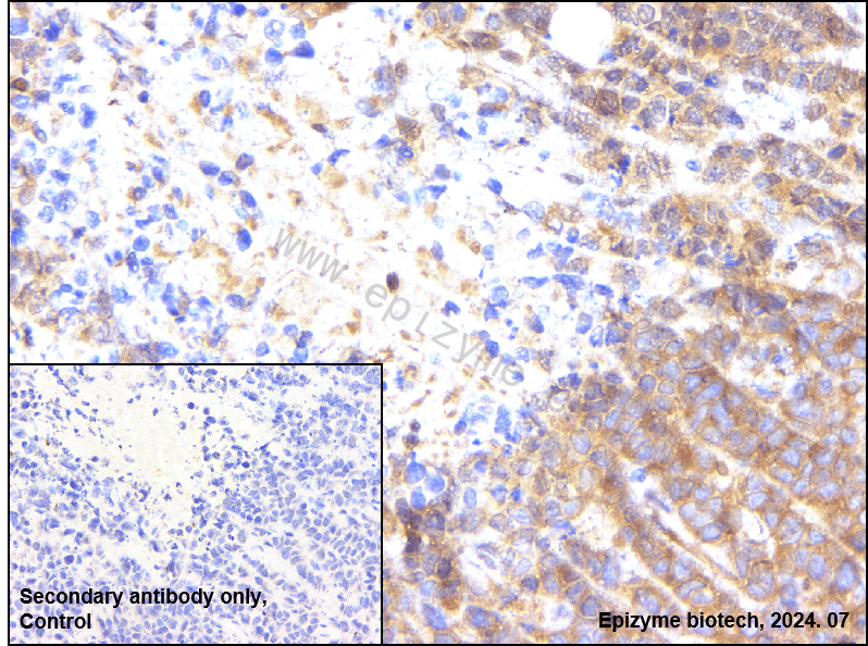 Anti-GSK3 alpha/beta Rabbit mAb [13K09G20]