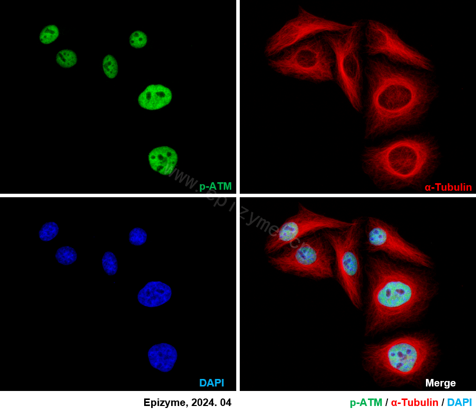 Anti-Phospho-ATM (Ser1981) Rabbit mAb [21D98L56]