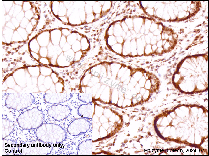Anti-Phospho-ATM (Ser1981) Rabbit mAb [21D98L56]