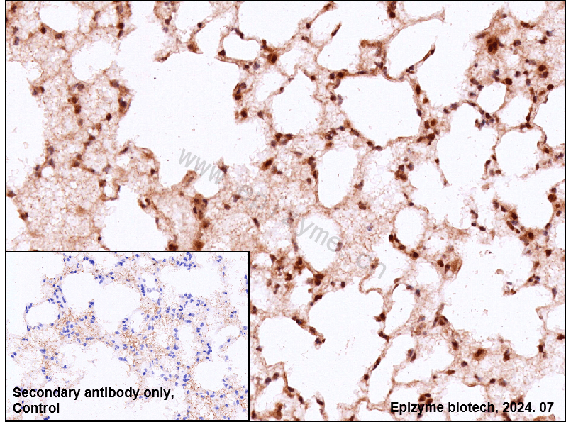 Anti-Phospho-ATM (Ser1981) Rabbit mAb [21D98L56]