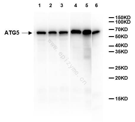 Anti-ATG5 Rabbit mAb [70B28L17]