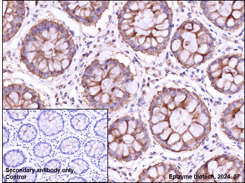 Anti-ATG5 Rabbit mAb [70B28L17]