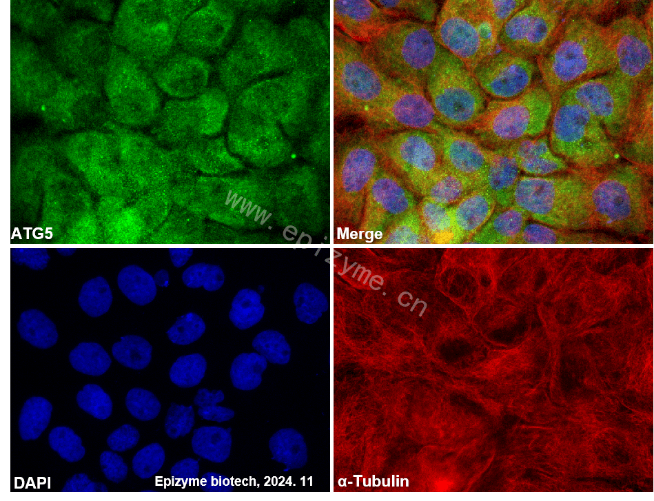 Anti-ATG5 Rabbit mAb [70B28L17]