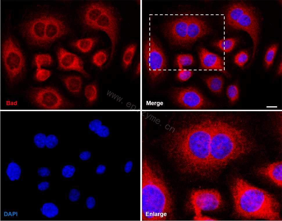 Anti-Bad Rabbit mAb [39D84M92]
