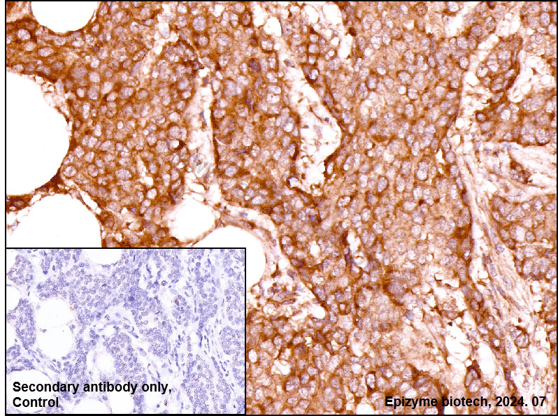 Anti-Bad Rabbit mAb [39D84M92]
